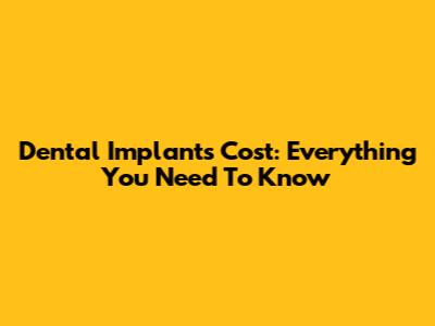 Dental Implants Cost: Everything You Need To Know